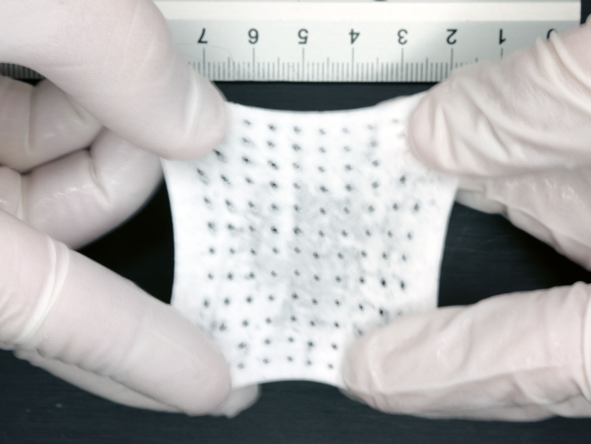 Kolejna generacja bioresorbowalnych implantów Regenity łączy polimery syntetyczne z kolagenem, aby poprawić efekty kliniczne
