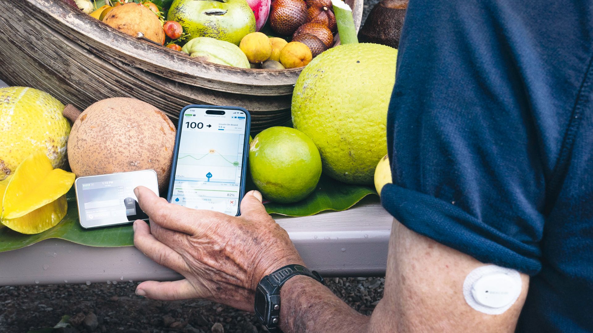 Sistema de circuito cerrado híbrido de Dexcom Deutschland GmbH