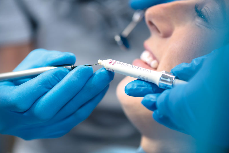 Tokuyama Dental lichthärtende Seitenzahnkomposit 