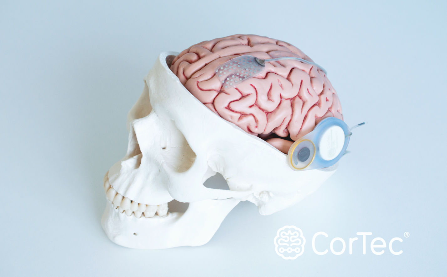 CorTec GmbH Betegség